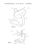 INFANT PACIFIER WITH IMPROVED RETENTION diagram and image