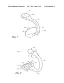 INFANT PACIFIER WITH IMPROVED RETENTION diagram and image