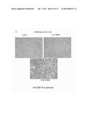 METHOD FOR TREATING FIBROSIS AND CANCER WITH IMIDAZOLIUM AND IMIDAZOLINIUM     COMPOUNDS diagram and image