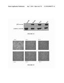 METHOD FOR TREATING FIBROSIS AND CANCER WITH IMIDAZOLIUM AND IMIDAZOLINIUM     COMPOUNDS diagram and image