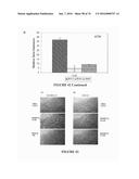 METHOD FOR TREATING FIBROSIS AND CANCER WITH IMIDAZOLIUM AND IMIDAZOLINIUM     COMPOUNDS diagram and image