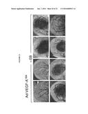 TARGETED TREATMENT OF ANEROBIC CANCER diagram and image