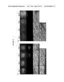 TARGETED TREATMENT OF ANEROBIC CANCER diagram and image