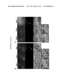 TARGETED TREATMENT OF ANEROBIC CANCER diagram and image