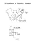 DEVICE AND METHOD FOR RAPID ASPIRATION AND COLLECTION OF BODY TISSUE FROM     WITHIN AN ENCLOSED BODY SPACE diagram and image