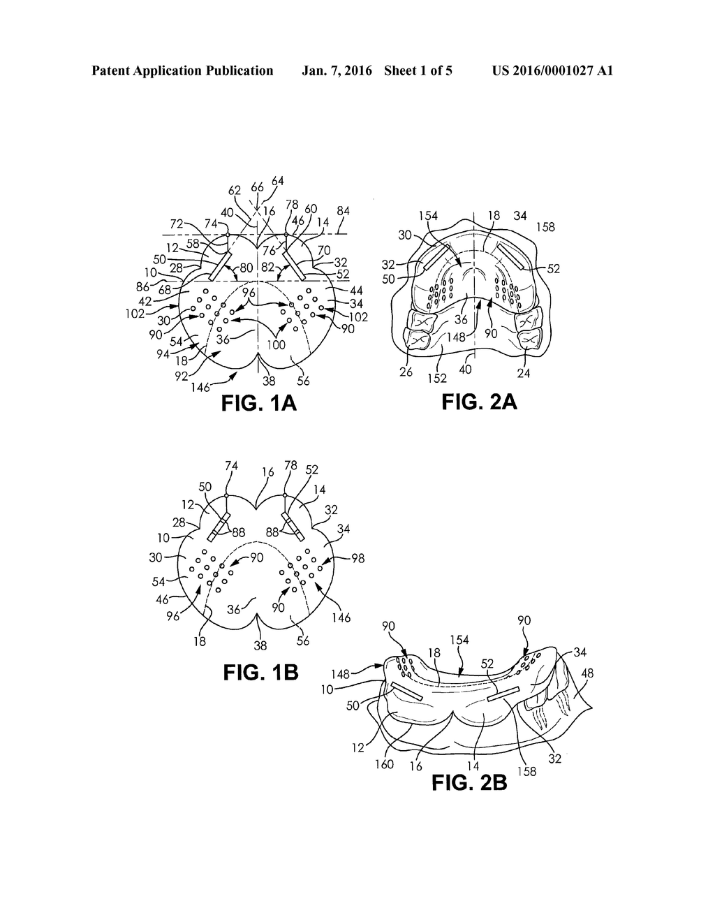 DENTAL APPLIANCE AND METHOD OF PROTECTING DENTITIONS DURING A TRANSORAL     PROCEDURE WITH THE APPLIANCE - diagram, schematic, and image 02