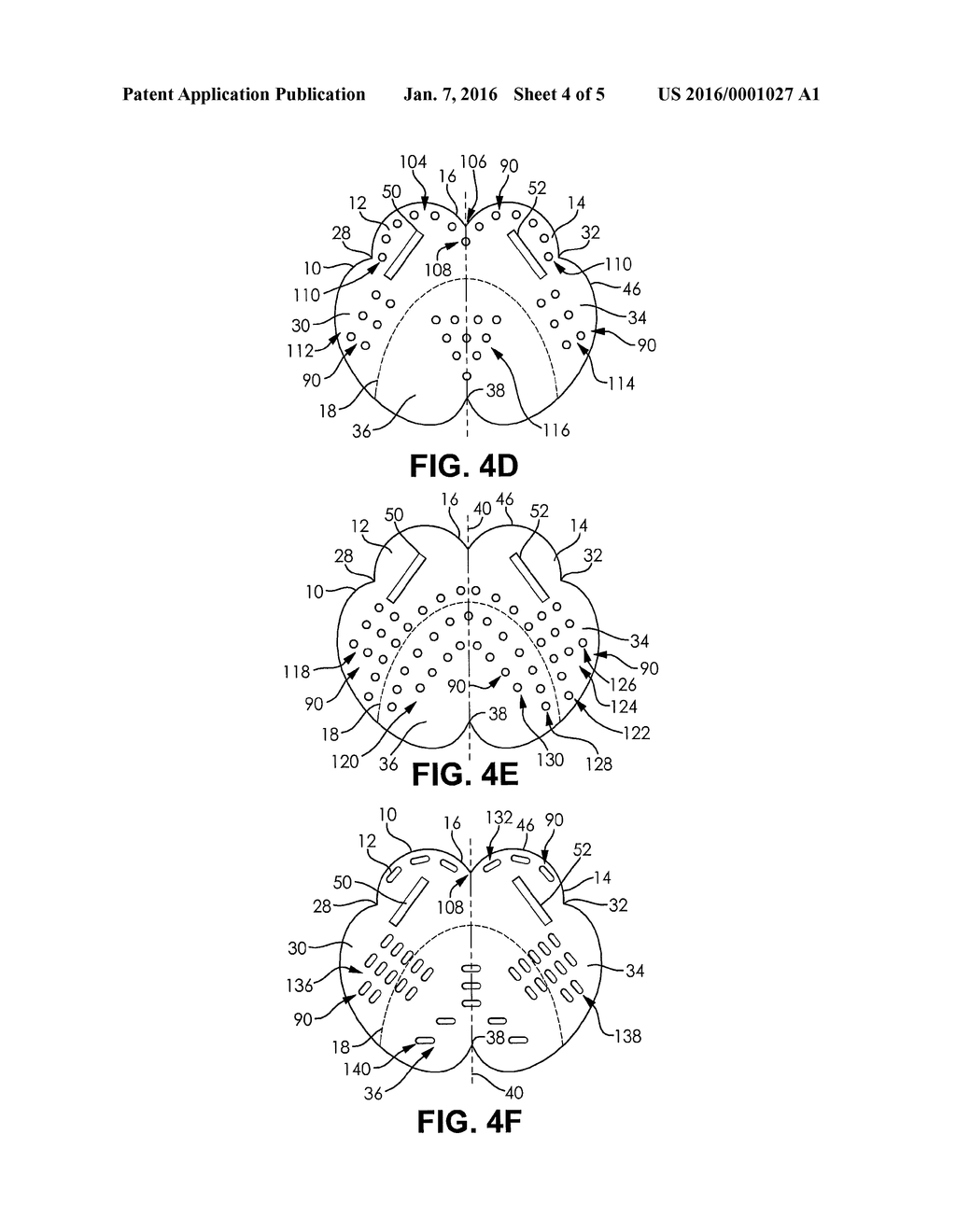 DENTAL APPLIANCE AND METHOD OF PROTECTING DENTITIONS DURING A TRANSORAL     PROCEDURE WITH THE APPLIANCE - diagram, schematic, and image 05