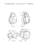 SEAL FORMING PORTION, PAD AND CUSHION FOR A PATIENT INTERFACE AND METHOD     OF MANUFACTURING diagram and image