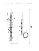 URETERAL STENT AND METHOD AND SYSTEM FOR ITS DEPLOYMENT diagram and image