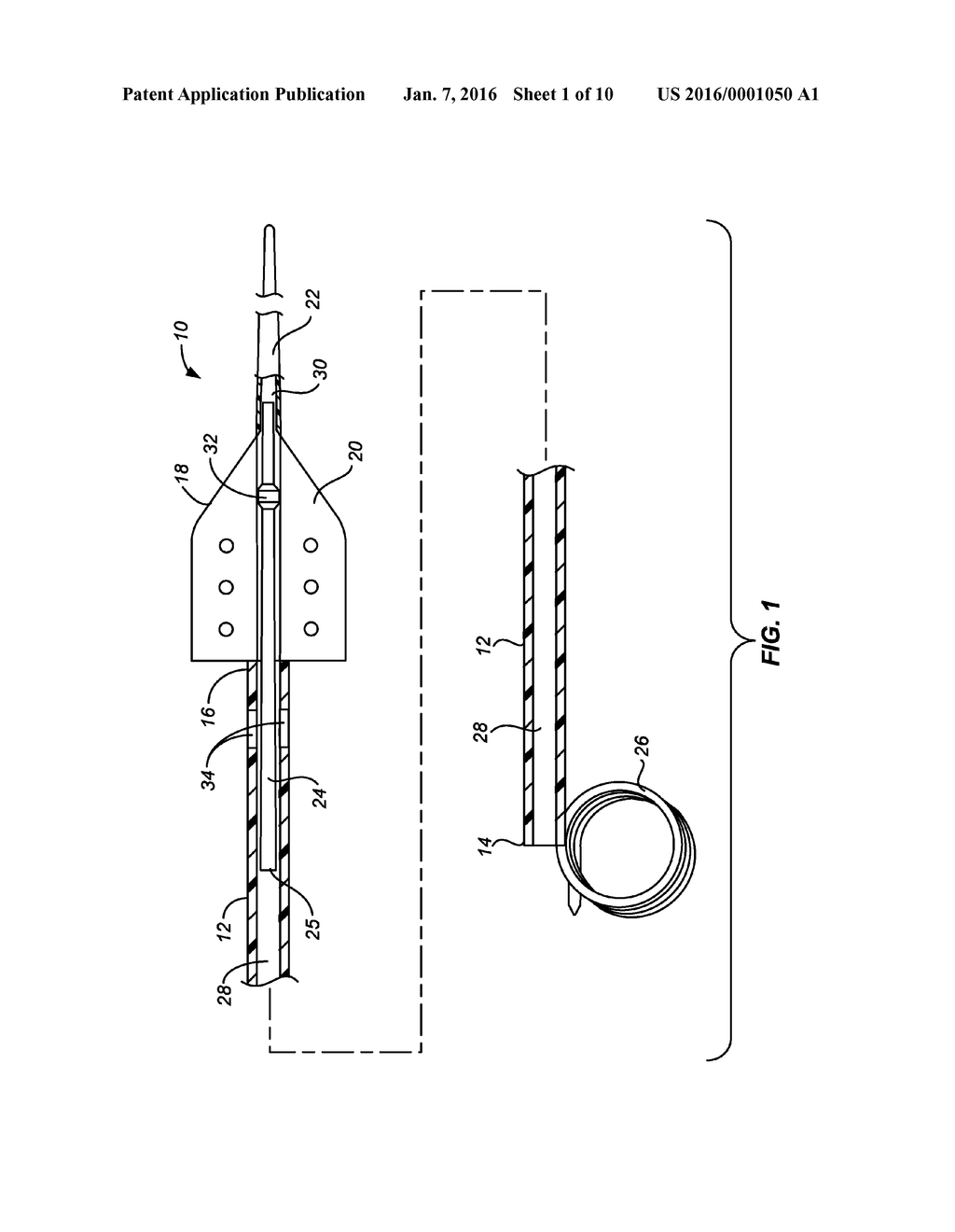 URETERAL STENT AND METHOD AND SYSTEM FOR ITS DEPLOYMENT - diagram, schematic, and image 02