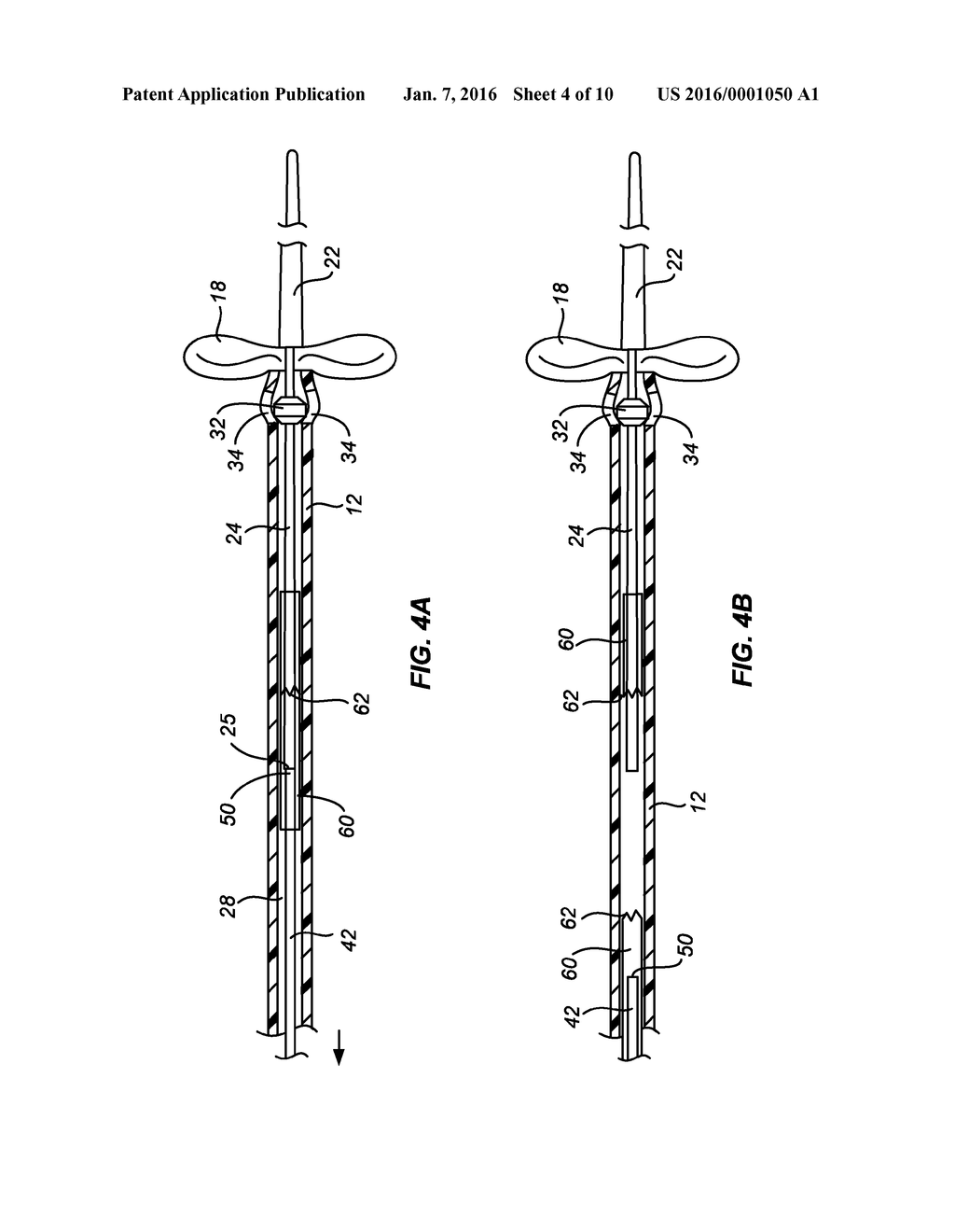 URETERAL STENT AND METHOD AND SYSTEM FOR ITS DEPLOYMENT - diagram, schematic, and image 05