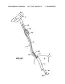 URETERAL STENT AND METHOD AND SYSTEM FOR ITS DEPLOYMENT diagram and image
