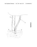 FIXATION FOR IMPLANTABLE MEDICAL DEVICES diagram and image