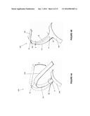 FIXATION FOR IMPLANTABLE MEDICAL DEVICES diagram and image