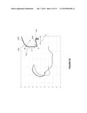 FIXATION FOR IMPLANTABLE MEDICAL DEVICES diagram and image