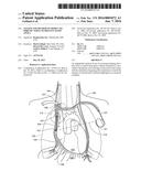 SYSTEM AND METHOD TO MODULATE PHRENIC NERVE TO PREVENT SLEEP APNEA diagram and image