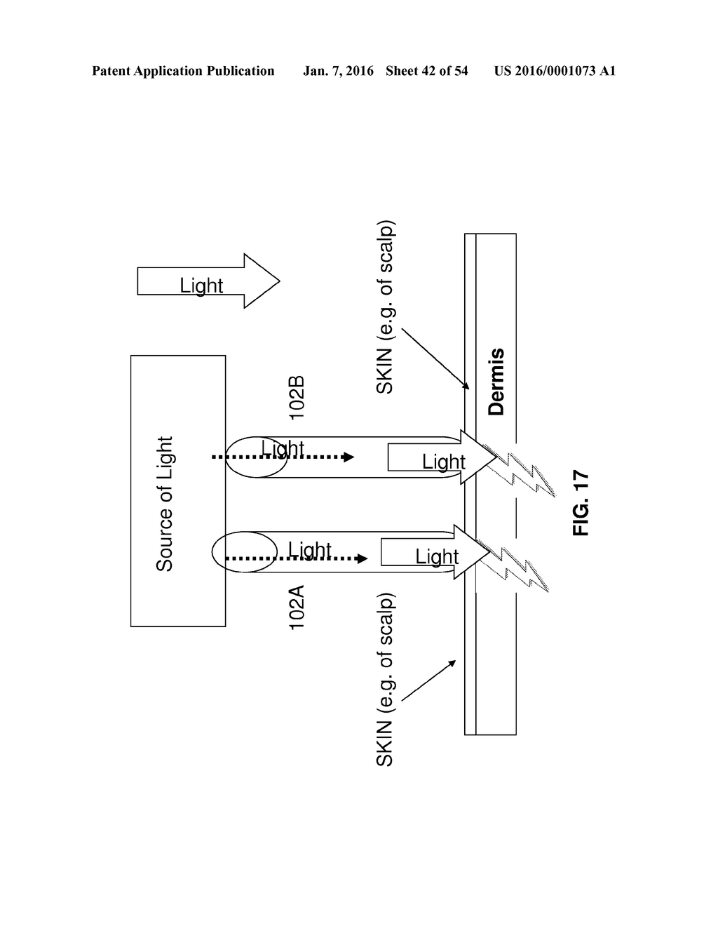 APPARATUS AND METHOD FOR STIMULATING HAIR GROWTH AND/OR PREVENTING HAIR     LOSS - diagram, schematic, and image 43