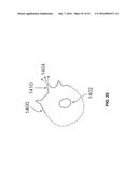 APPARATUS AND METHOD FOR STIMULATING HAIR GROWTH AND/OR PREVENTING HAIR     LOSS diagram and image