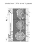 SYSTEM AND METHOD FOR DETERMINING TARGET STIMULATION VOLUMES diagram and image