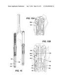 SUSPENSION SYSTEM diagram and image