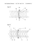 TIE STRIPS diagram and image