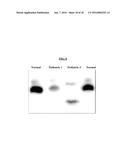 METHODS FOR THE TREATMENT OF MITOCHONDRIAL DISEASE diagram and image