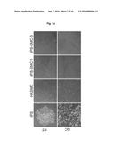 METHOD FOR SUPPRESSING TERATOMA FORMATION VIA SELECTIVE CELL DEATH     INDUCTION IN UNDIFFERENTIATED HUMAN-INDUCED PLURIPOTENT STEM CELLS diagram and image