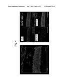 SKIN ACTIVATION BY ACCELERATION OF PDGF-BB ACTIVITY diagram and image