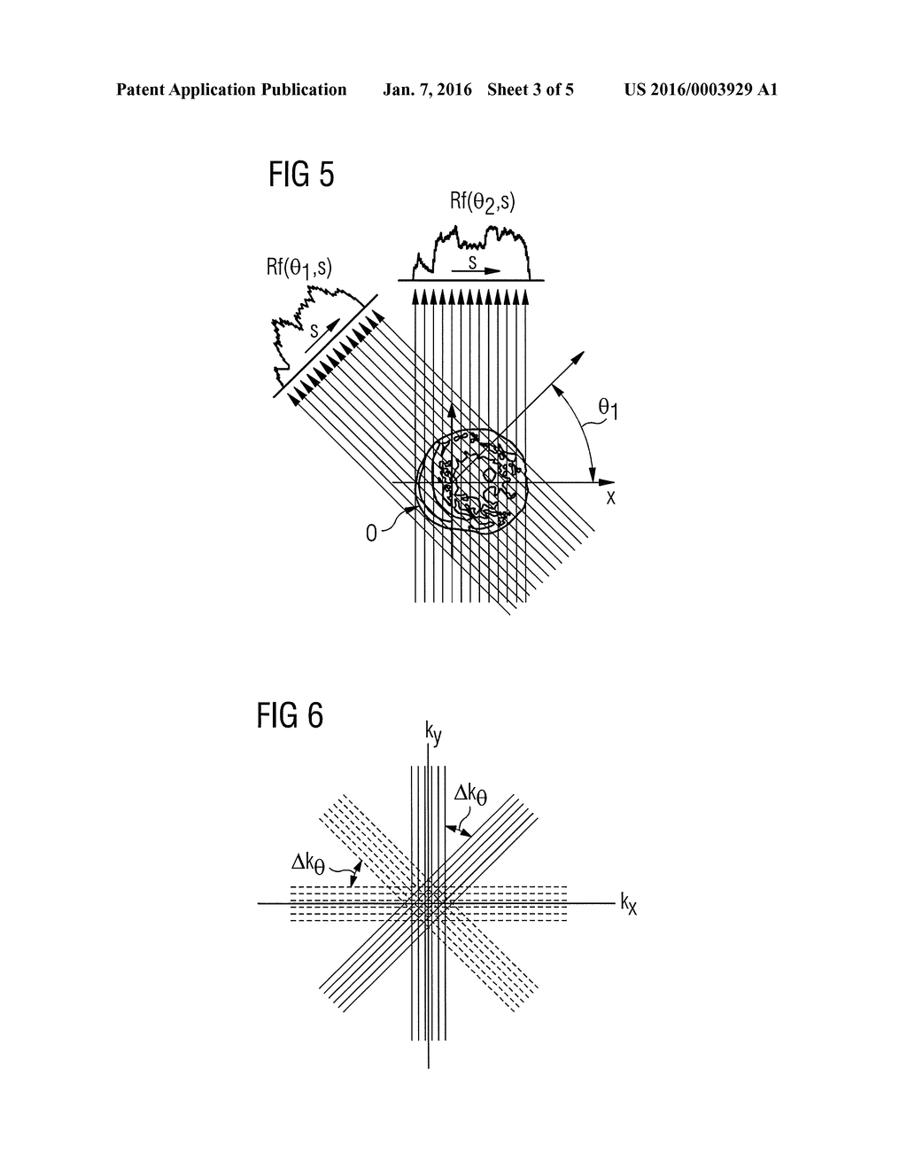 MAGNETIC RESONANCE IMAGING WITH DIFFERENT FREQUENCY ENCODING PATTERNS - diagram, schematic, and image 04