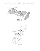 DETECTING TOOTH WEAR USING INTRA-ORAL 3D SCANS diagram and image