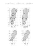 DETECTING TOOTH WEAR USING INTRA-ORAL 3D SCANS diagram and image