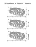 DETECTING TOOTH WEAR USING INTRA-ORAL 3D SCANS diagram and image