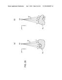 SHAPE RECOGNITION DEVICE, SHAPE RECOGNITION PROGRAM, AND SHAPE RECOGNITION     METHOD diagram and image