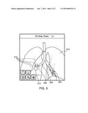 DYNAMIC 3D LUNG MAP VIEW FOR TOOL NAVIGATION INSIDE THE LUNG diagram and image