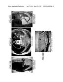 PERIMETER-MONITORING DEVICE FOR WORKING MACHINE diagram and image