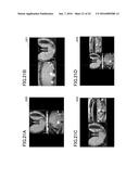 PERIMETER-MONITORING DEVICE FOR WORKING MACHINE diagram and image