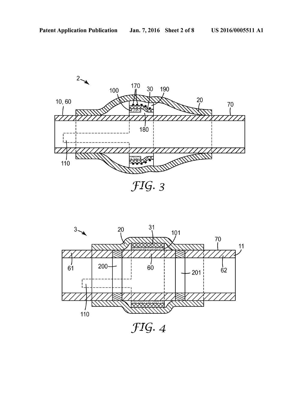 SLEEVE FOR A POWER CABLE - diagram, schematic, and image 03