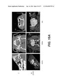 Animal Models of Cancer diagram and image