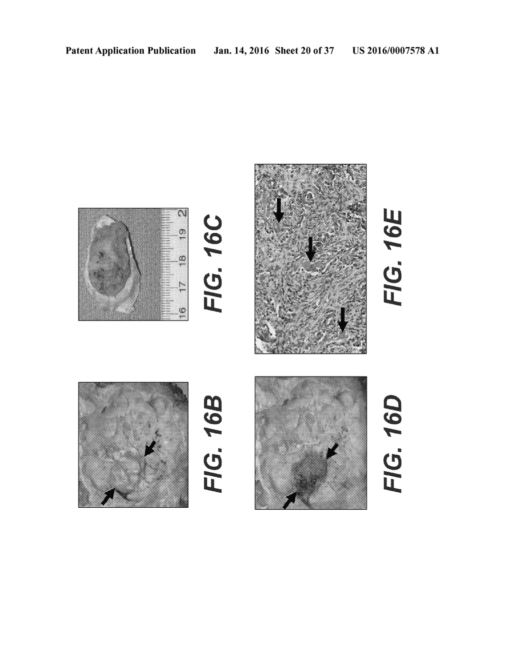 Animal Models of Cancer - diagram, schematic, and image 21