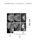 Animal Models of Cancer diagram and image