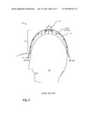 Power-Ventilated Soft Headgear diagram and image