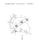 Guidewire Navigation for Sinuplasty diagram and image