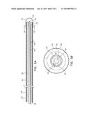 Guidewire Navigation for Sinuplasty diagram and image