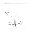 Ambulatory Electrocardiography Monitoring Patch Optimized For Capturing     Low Amplitude Cardiac Action Potential Propagation diagram and image