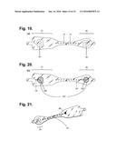 Ambulatory Electrocardiography Monitoring Patch Optimized For Capturing     Low Amplitude Cardiac Action Potential Propagation diagram and image