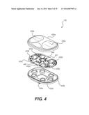 SYSTEMS AND METHODS FOR MEASURING PERFORMANCE PARAMETERS RELATED TO     ORTHOPEDIC ARTHROPLASTY diagram and image