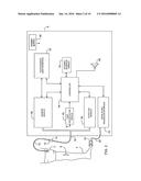 Personalized Tourniquet Apparatus diagram and image