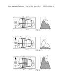 Personalized Tourniquet Apparatus diagram and image