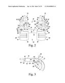 METHOD OF ASSEMBLING AND POSITIONING A FEMORAL ORTHOPAEDIC SURGICAL     INSTRUMENT diagram and image