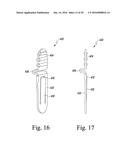 METHOD OF ASSEMBLING AND POSITIONING A FEMORAL ORTHOPAEDIC SURGICAL     INSTRUMENT diagram and image